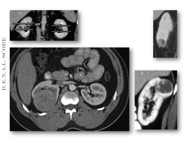 diapositiva08