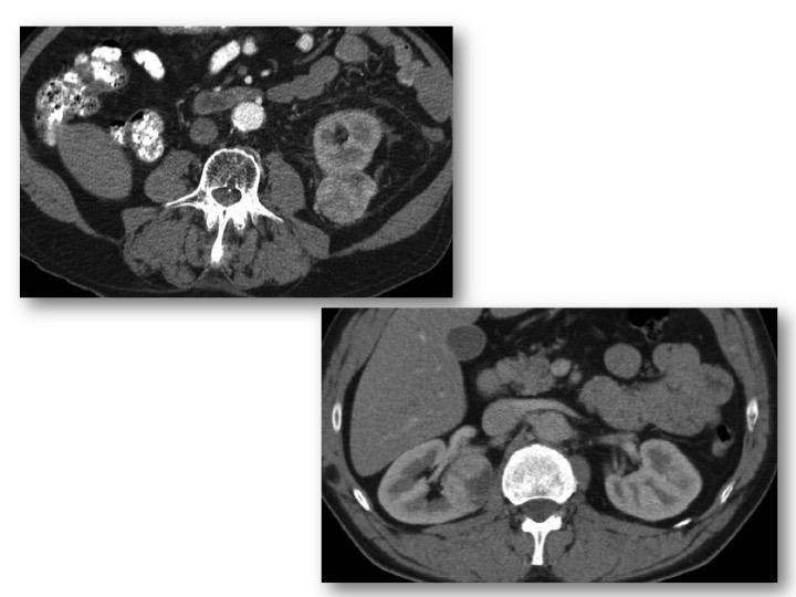 diapositiva09