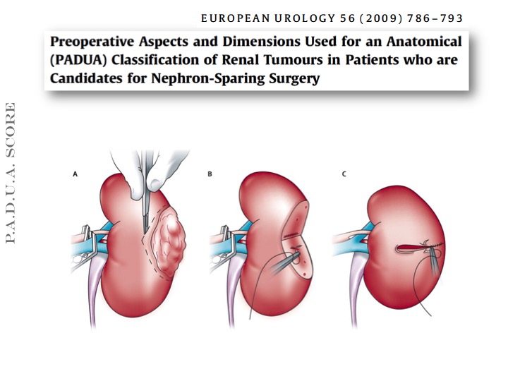 diapositiva16