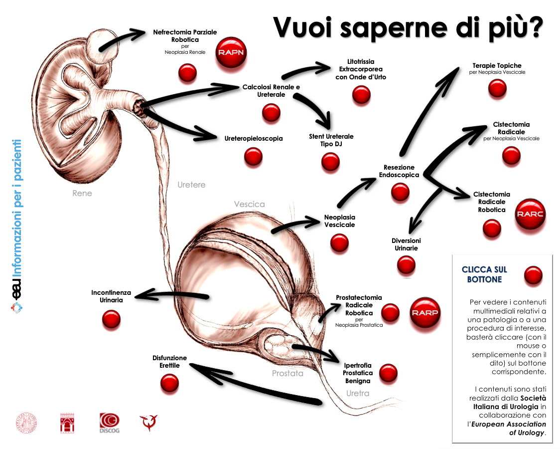 EAU patient information